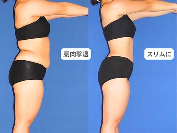 ピュアノア 垂水店/痩身ダイエット　神戸垂水明石