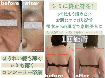 シンプル(Simple)の写真