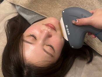 ビューティーソレイユ(BEAUTY SOLEIL)/フェイス脱毛