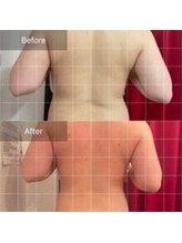 エモーション(E Motion)/before→after☆