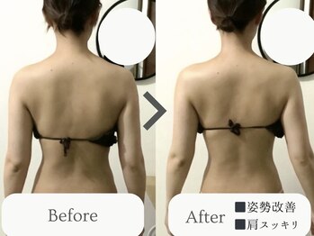エミィ(emmy)/パワーレメディ Before→After