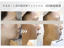 エステティックサロン シーズの雰囲気(#たるみ #ハリ #小顔 #リフトアップ)