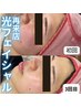 ＜しみ予防に最適♪＞肌質改善*光フェイシャル 7,700円