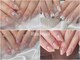 リノネイル(Rino-nail)の写真