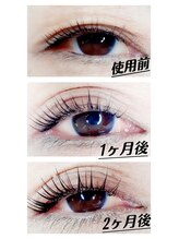 スリール(Sourire)/まつげ美容液の効果