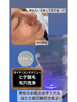 チーズ(CHI’S)/男性のお肌メンテ増えてます！
