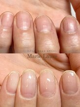 マリーロール 梅田店(Marie Laure)/自爪育成/深爪矯正/ネイルケア