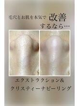 ピエル 北千住店(PIEL)/毛穴とお肌を本気で改善するなら