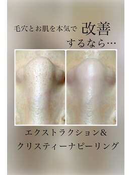 ピエル 北千住店(PIEL)/毛穴とお肌を本気で改善するなら