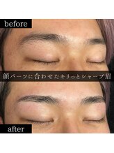 ユー 千葉駅前店(you)/ビフォーアフター写真