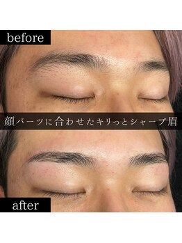 ユー 千葉駅前店(you)/ビフォーアフター写真