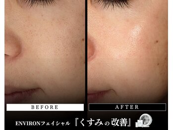 メディケア 新宿/ENVIRON フルコース【くすみ】