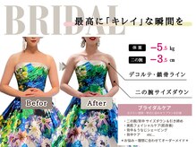 グレースエール トータルビューティーサロン(Grace Aile)の雰囲気（なりたい理想の姿へ＊二の腕・背中のサイズダウンブライダル）