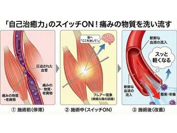 藤本整骨院 鍼灸院 長崎岩屋町本院/なぜ鍼灸施術が必要なのか★