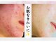 リヴェーヌ 富山店の写真/【素肌を育てる方法で、根本改善◎】あなたに合わせたやり方で、豊富な知識のプロが全力でフォローします！