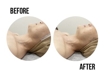 イードット(E.)/自分へのご褒美に♪