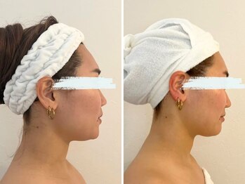 マキシフォート 名駅店(Maxifort)/小顔コルギ体験レポート