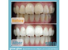 グロウ グロウ(grow.glow)
