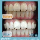 グロウ グロウ(grow.glow)