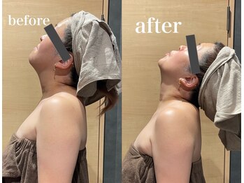 ビーバイビー(BBYB)/首のこり10分で解決!