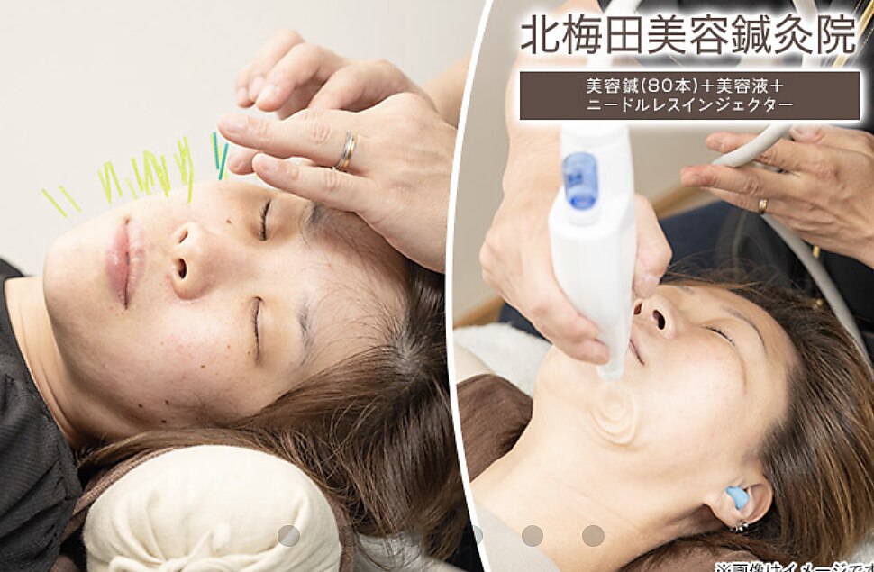 北梅田美容鍼灸院｜ホットペッパービューティー