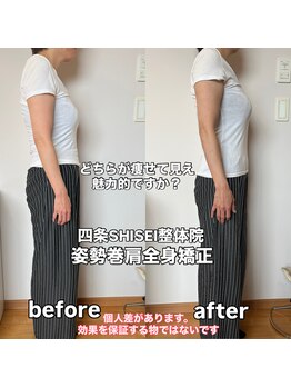 四条シセイ整体院(SHISEI整体院)/ビフォーアフター