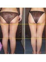 ヘルシースリムなにわ/リンパ整体90分10回｜腰痛も改善