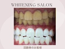 ホワイト つくば店(WHITE)/