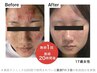 【ご新規様★人気No1】 自分史上最強のお肌を目指す★圧倒的実力で理想の肌に