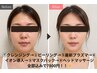 No1人気★最高出力!最新プラズマエステ¥7800(ヘッドマッサージ付き♪)
