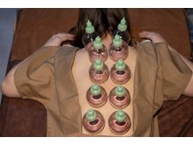 カラダキュア 東京銀座/カッピング