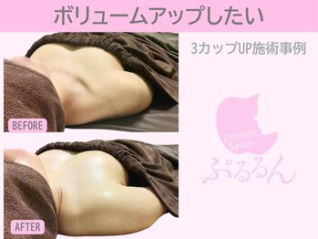 ぷるるんエステ/バストケア/バストアップ/育乳