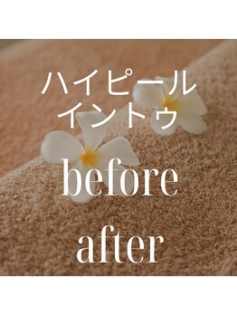 リラクゼーションサロン ラキ(laki)/ハイピールイントゥ/ピーリング