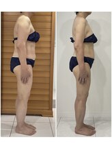 エゴ(EGO)/70代前半　154.5cm 4.8キロ減