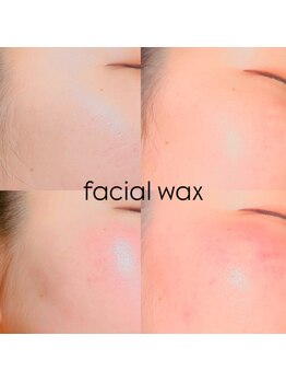 ゴリラアイブロウ 札幌大通店/肌を整えるフェイシャルWax