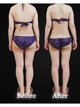 サンティエ(Santie)/計８回施術で大変身