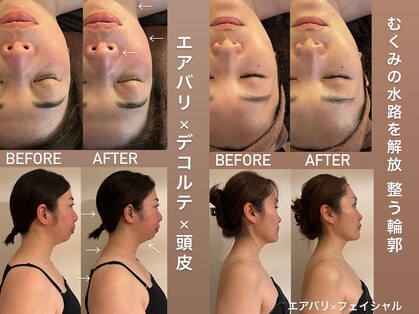 アンミー(anmiiy)の写真