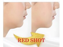 ジヒカ(ZIHICA)/ 【最新☆RED SHOT】輪郭形成