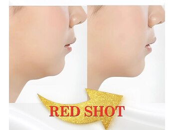 ジヒカ(ZIHICA)/ 【最新☆RED SHOT】輪郭形成