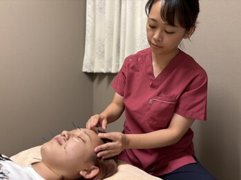 ハートテラス整骨院 鍼灸院の写真/女性鍼灸師が施術♪美容鍼でハンドでは届かない深部へアプローチ！表情筋を引き上げ、小顔リフトアップ！