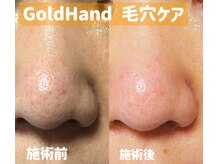 ゴールドハンド 溝の口店(Gold Hand)/毛穴スキンケアフェイシャル