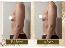 マリン(MARINE)/デコルテふんわり♪お腹スッキリ