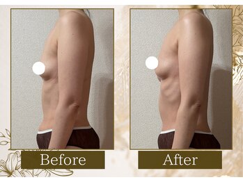 マリン(MARINE)/デコルテふんわり♪お腹スッキリ