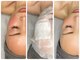 ティアラ(TIARA)の写真/NEW★小顔専門店が構築【上半身まるごと頭蓋骨小顔矯正】×肌質改善【ハイドロ水素パック】