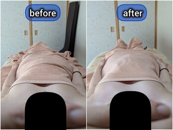 スノードロップ(snowdrop)/２０代の方　バストアップ