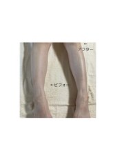 カノン(KANON)/足のリンパドレナージュ