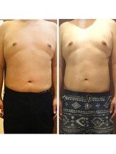 プリンセス バイ セイフティプリンセス 長野店(PRINCESS)/超強力EMS系フィットカービング