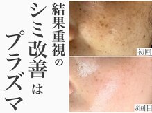 レイ(Rey)/結果重視オーダーメイドシミケア