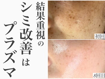 レイ(Rey)/結果重視オーダーメイドシミケア