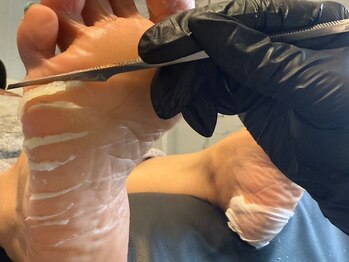 パッソ(Passo)/韓国式足裏角質ケア